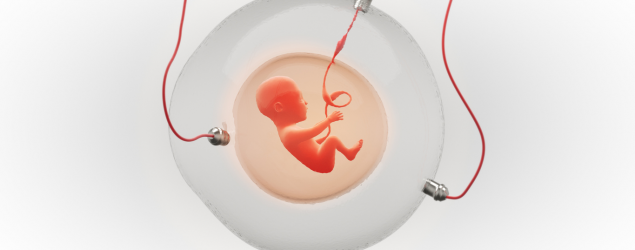 Artificial Womb