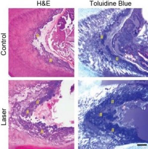 light-coaxes-stem-cells-to-repair-teeth